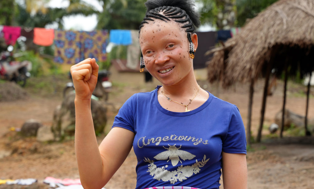 A girl holds her arm up to show her strength